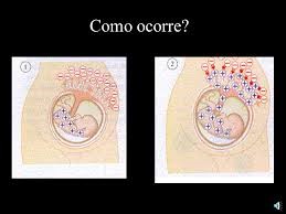 anemia-eristroblastose-fetal-04