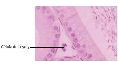 Célula de Leydig